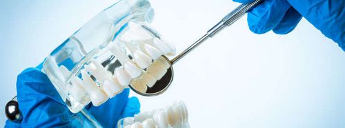Indlæg: så du fylder dit tandhul af høj kvalitet og effektiv, dentolo